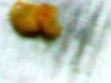 Larva albina - Asta este a doua - BOLI SI DAUNATORI - TRATAMENTE