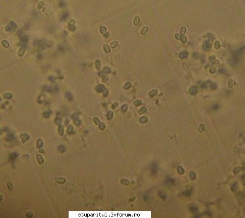 Nosemoza - Foto spori de nosema apis la microscop - BOLI SI DAUNATORI - TRATAMENTE
