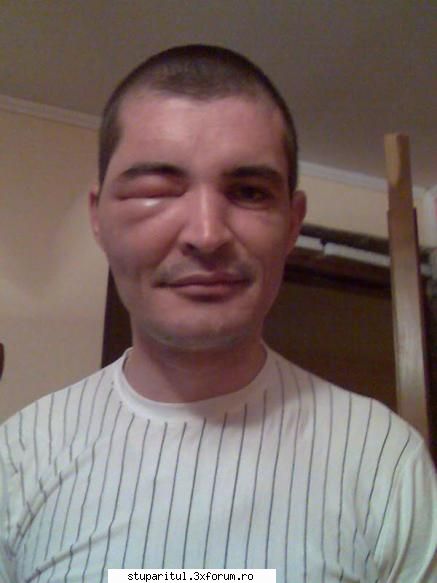 ochiul si pepenele - ciptheman - PAGINA APICULTORULUI INCEPATOR